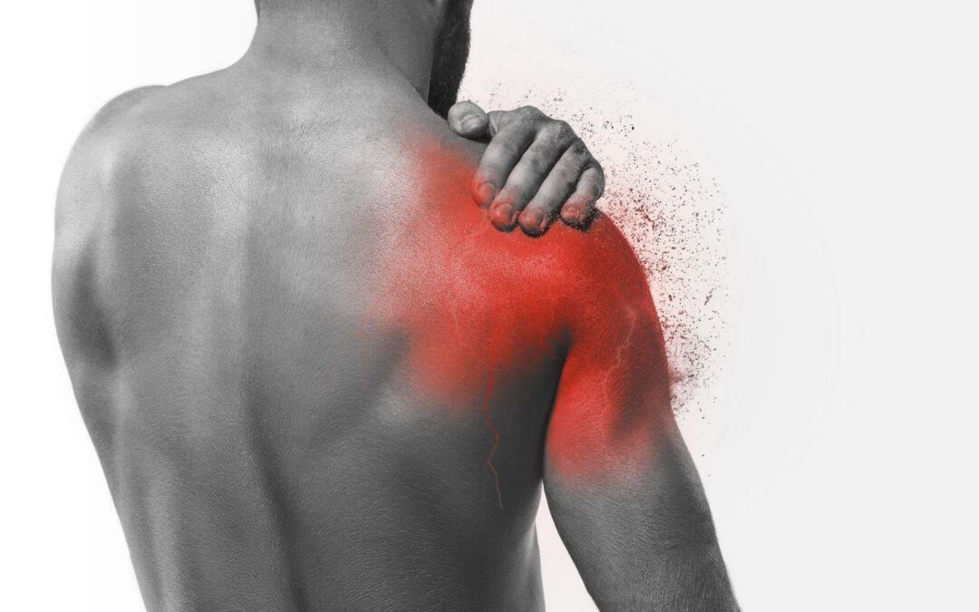 Frozen Shoulder – the role of Physiotherapy